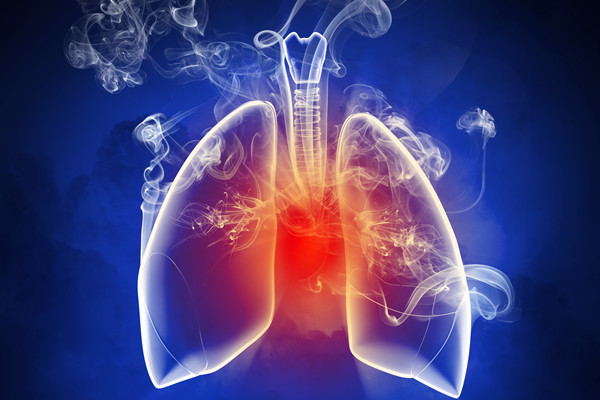 肺结核复发怎么治