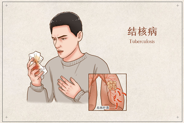 结核的治疗方法有哪些