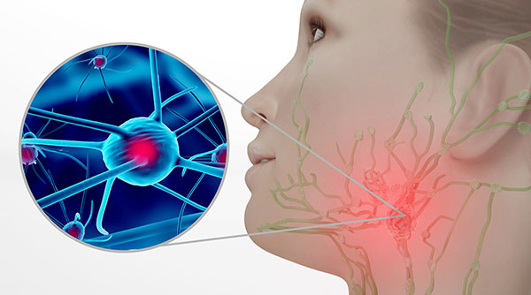 淋巴结核怎么治疗 淋巴结核怎么治疗