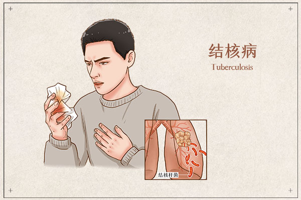 肺结核怎么治疗好的快