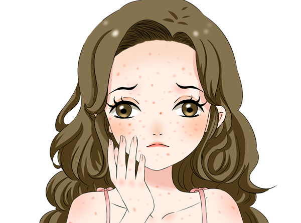 肺结核用药后过敏 肺结核用药后过敏