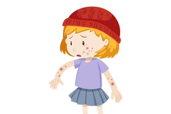 骨结核用药过敏怎么办