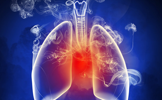 肺结核高危人群有哪些，该怎么治疗